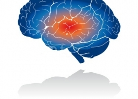 Comprendre la maladie d'Alzheimer et les démences